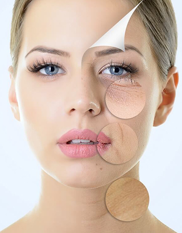RECTANGLE PEELING MOYEN